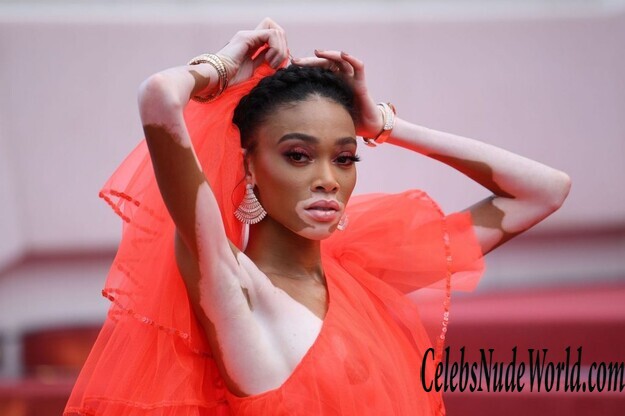 Winnie Harlow Erotic 180946